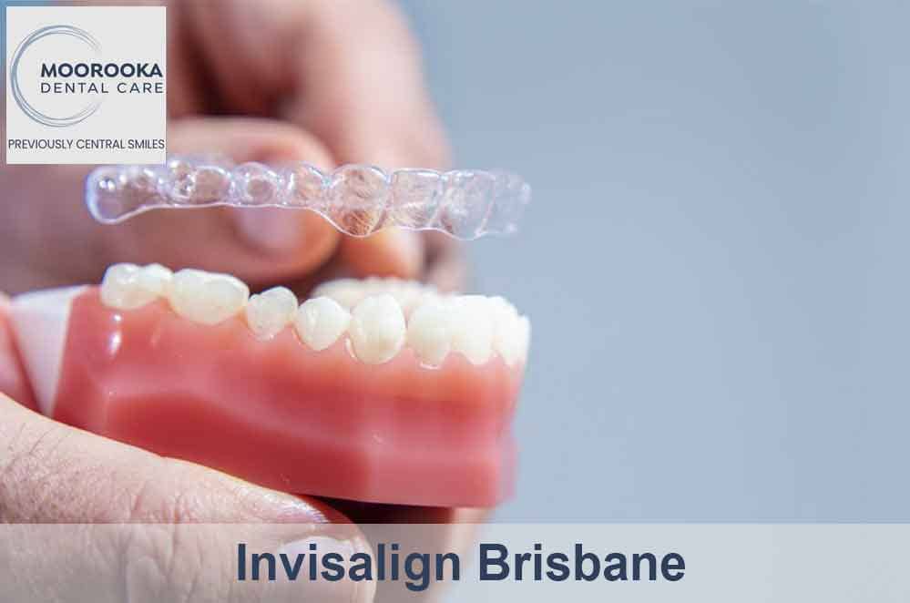 Invisalign dentist in Brisbane