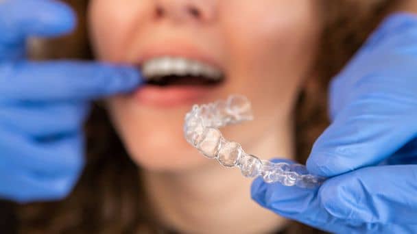 invisalign clear aligners