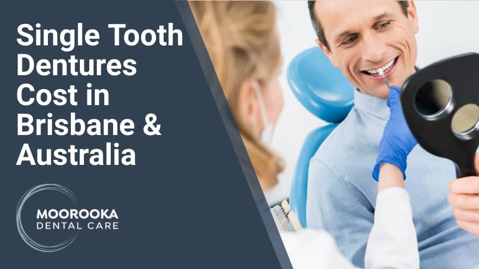 Single Tooth Dentures Cost in Brisbane and Australia MOOROOKA